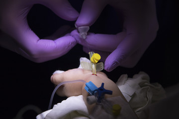 Catheter in little child's arm with a drop of blood and anesthesiologist's hands pull out the needle