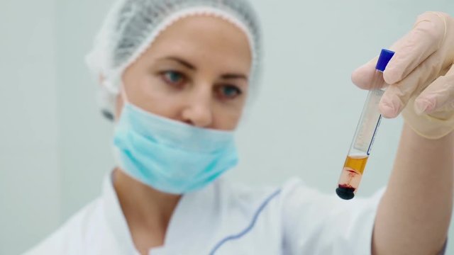 Doctor show a tube with plasma blood in laboratory