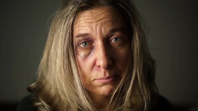 4k footage, portrait of worried woman with black eye and tears suffering from domestic violence

