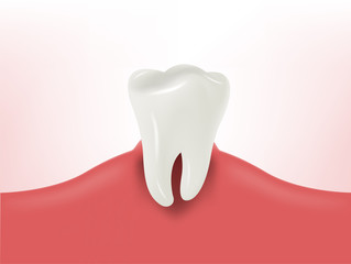 beautiful illustration of realistic tooth on gum, dental health design concept, decayed tooth