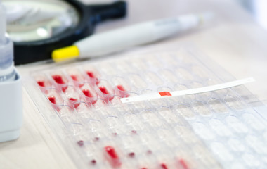 Litmus strips for blood analysis on pallets with the blood to determine the Rh factor.