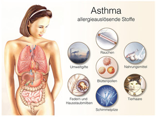 Asthma-Auslöser.Allergien.Bronchien - obrazy, fototapety, plakaty