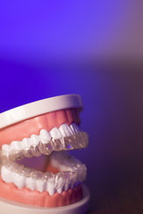 Denture with transparent orthodontics