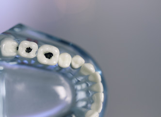 Denture for dentistry students