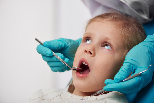 Milk Teeth Disease. Woman Doctor Examining Child Mouth With Mirror. 