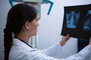 Female doctor examining x-ray report