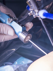 Surgical operation knee surgery
