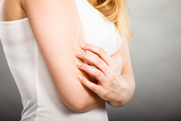Fototapeta na wymiar woman scratching her itchy arm with allergy rash