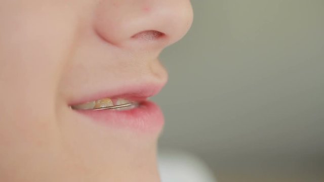 smiling child with braces on teeth