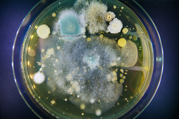 Petri dishes with growing microflora. Study hygiene premises restaurants. food safety