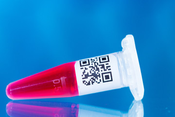 Medical equipment for Blood test. Blood test tube in laboratory.