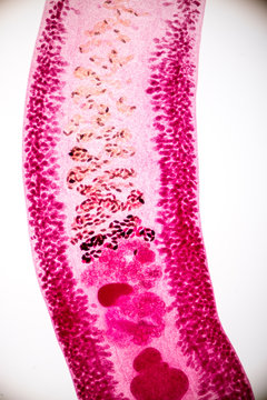 Echinostoma revolutum parasite on slide under microscope view.