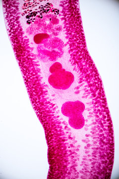 Echinostoma revolutum parasite on slide under microscope view.