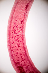 parasite on slide under microscope view.