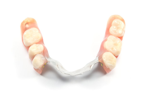 Partial denture upper side - dental prosthetics isolated on whit