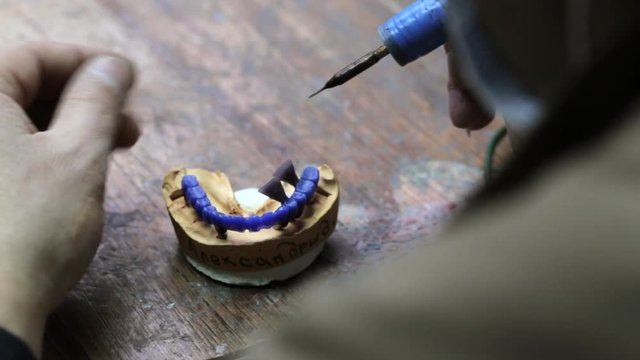 Close-up of ceramet implant creature process at laboratory. Technician creating a model for cermet implant.