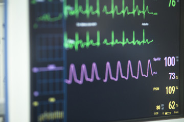 Electrocardiograph in hospital surgery