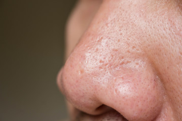 Thermometer © jakkrid