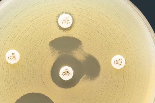 Keyhole test ESBLs positive by diffusion method test; focus on a