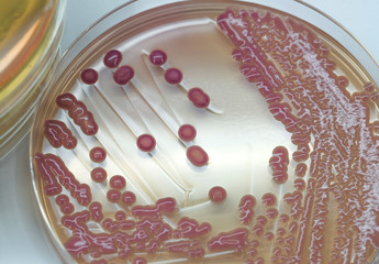 Klebsiella pneumoniae or Klebsiella spp.