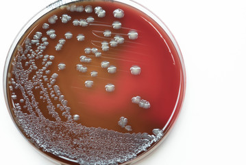 Bacterial culture growth on Blood agar (Gram negative bacilli)