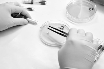  bacterial culture and drug resistance of pathogens in laborator
