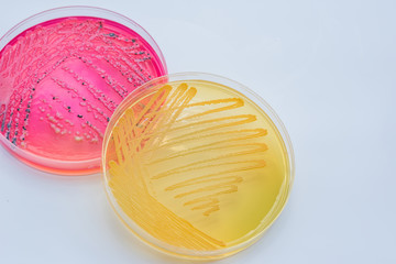 Bacterial colonies culture on  selective agar media XLT Agar (Xy