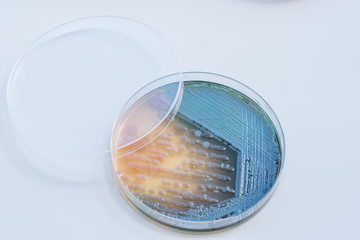 Bacterial colonies culture on  selective agar media XLT Agar (Xy