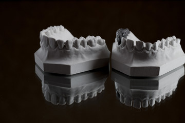 photograph of the lower jaw on a black background