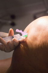 Anaesthetic injection in surgery