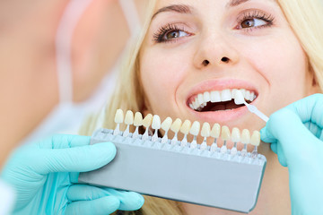 Closeup of a girl with beautiful smile at the dentist. Dental care concept. Whitening - obrazy, fototapety, plakaty