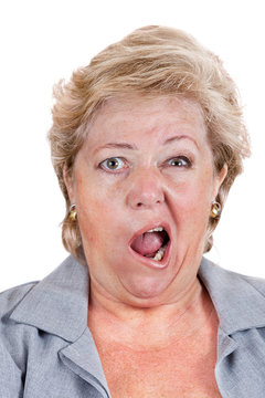 Bell's Palsy - lopsided screaming