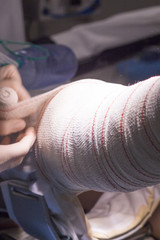Bandaging post knee surgery