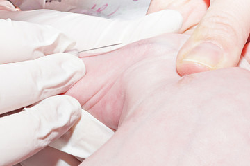 Obraz na płótnie Canvas Intravenous catheterization of newborn baby in neonatal intensive care unit