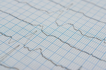 Close up of an electrocardiogram in paper form