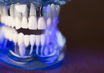 Fototapeta na wymiar Denture for dentistry students