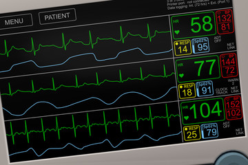 Patient's vital signs on ICU monitor closeup