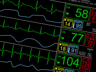 Patient's vital signs on ICU monitor, isolated closeup, dutched right