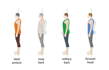 types of posture in men. vector illustration.