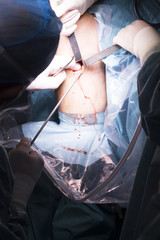 Surgical operation knee surgery