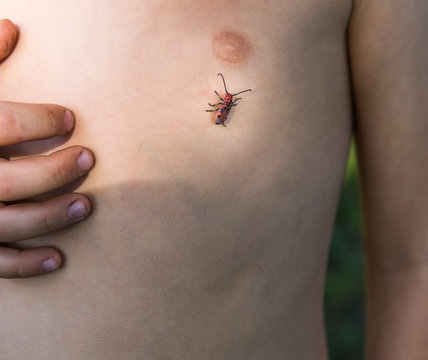 Boy with insect on chest