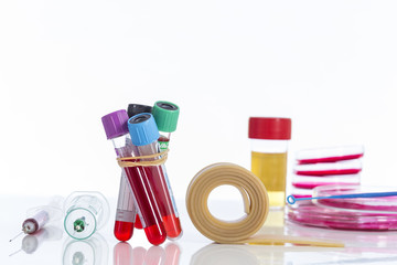 rack with several tubes blood , plates petri and the background urine samples in the laboratory
