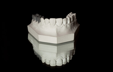 the upper jaw of plaster, photograph of the lower jaw on a black background