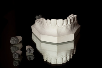 the upper jaw of plaster, photograph of the lower jaw on a black background © Babyntsev Dmitrii