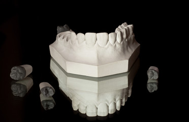 the upper jaw of plaster, photograph of the lower jaw on a black background © Babyntsev Dmitrii
