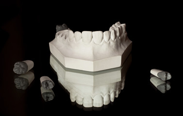 the upper jaw of plaster, photograph of the lower jaw on a black background © Babyntsev Dmitrii