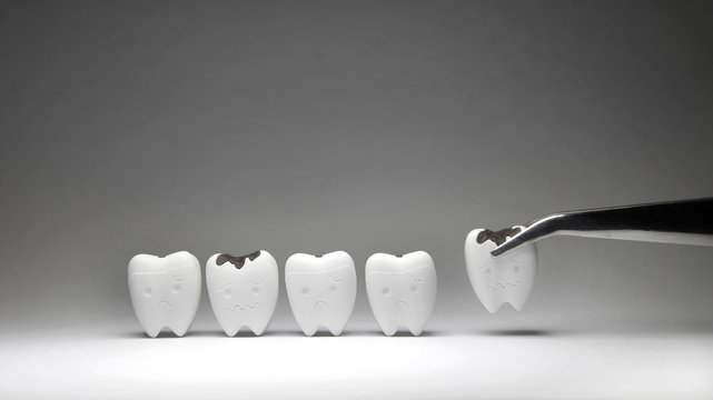 Decayed tooth model was pinch if don't brush the teeth every day, tooth will not unhealthy 