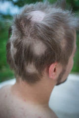 Obraz premium Young man closeup portrait with damaged hair