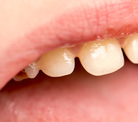 baby teeth. macro