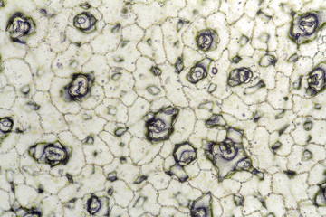 Bryophyllum cell structure